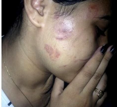 garota-espancada-472x430-1