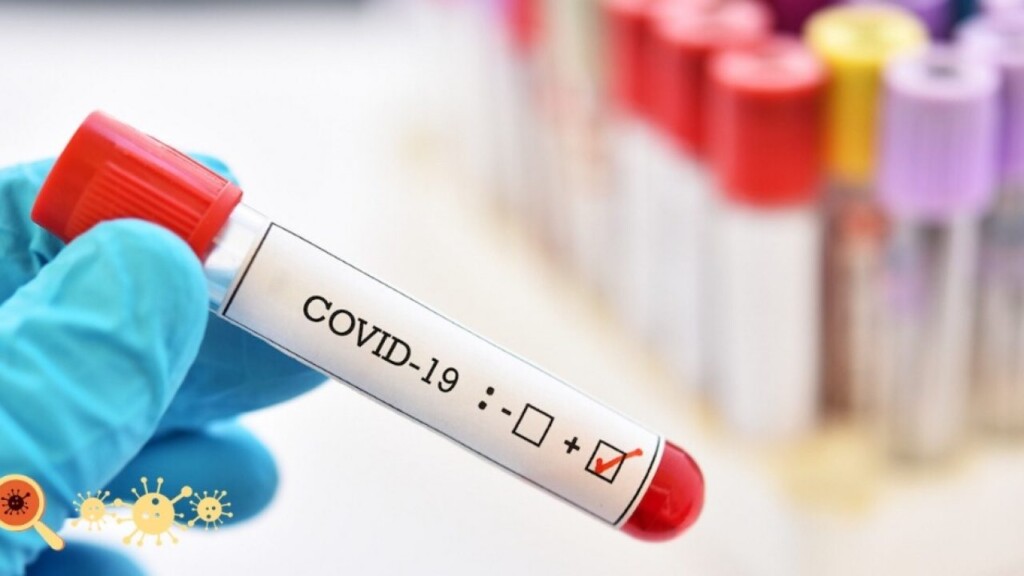 teste-covid-1280x720-1