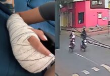 Fisioterapeuta é perseguida e atacada com barra de ferro no caminho para o trabalho em Campo Grande